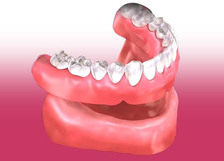 5 Tips to Take Care of Your Prosthetic Teeth